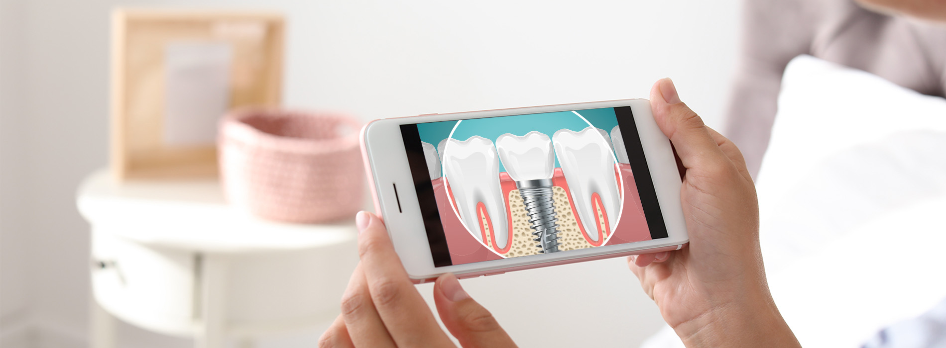 A person holding a smartphone with an app open displaying a dental implant procedure on a screen.